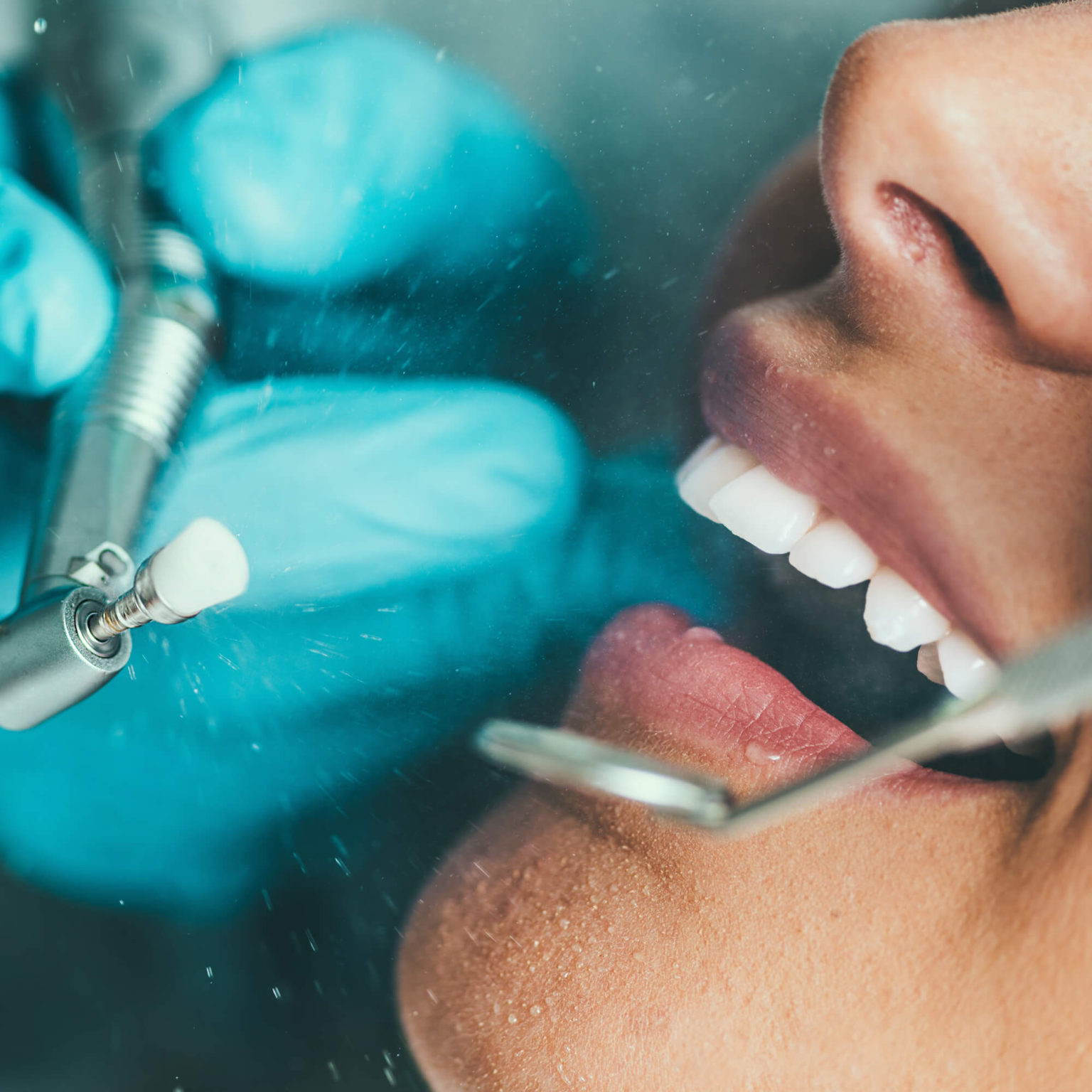 teeth-cleaning-in-sydney-sydney-cbd-dentistry